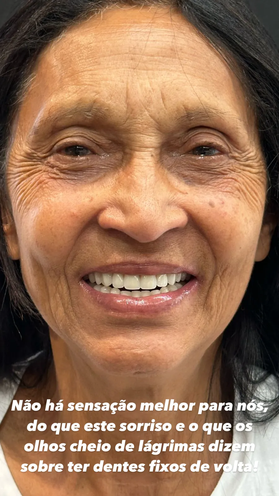 Paciente emocionada com o novo sorriso fixo