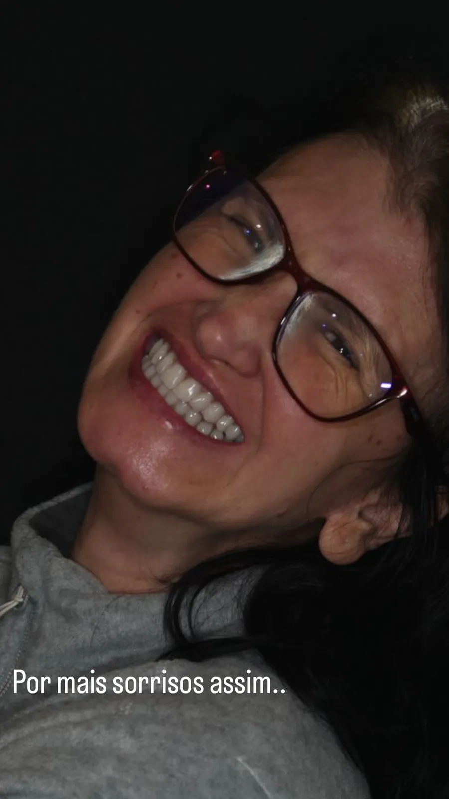 Paciente sorrindo com prótese sobre implantes